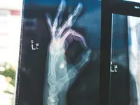 google-open-source-ai-models-medgemma-healthcare-artificial-intelligence-health-medicine-1024...webp google-open-source-ai-models-medgemma-healthcare-artificial-intelligence-health-medicine-1024...webp